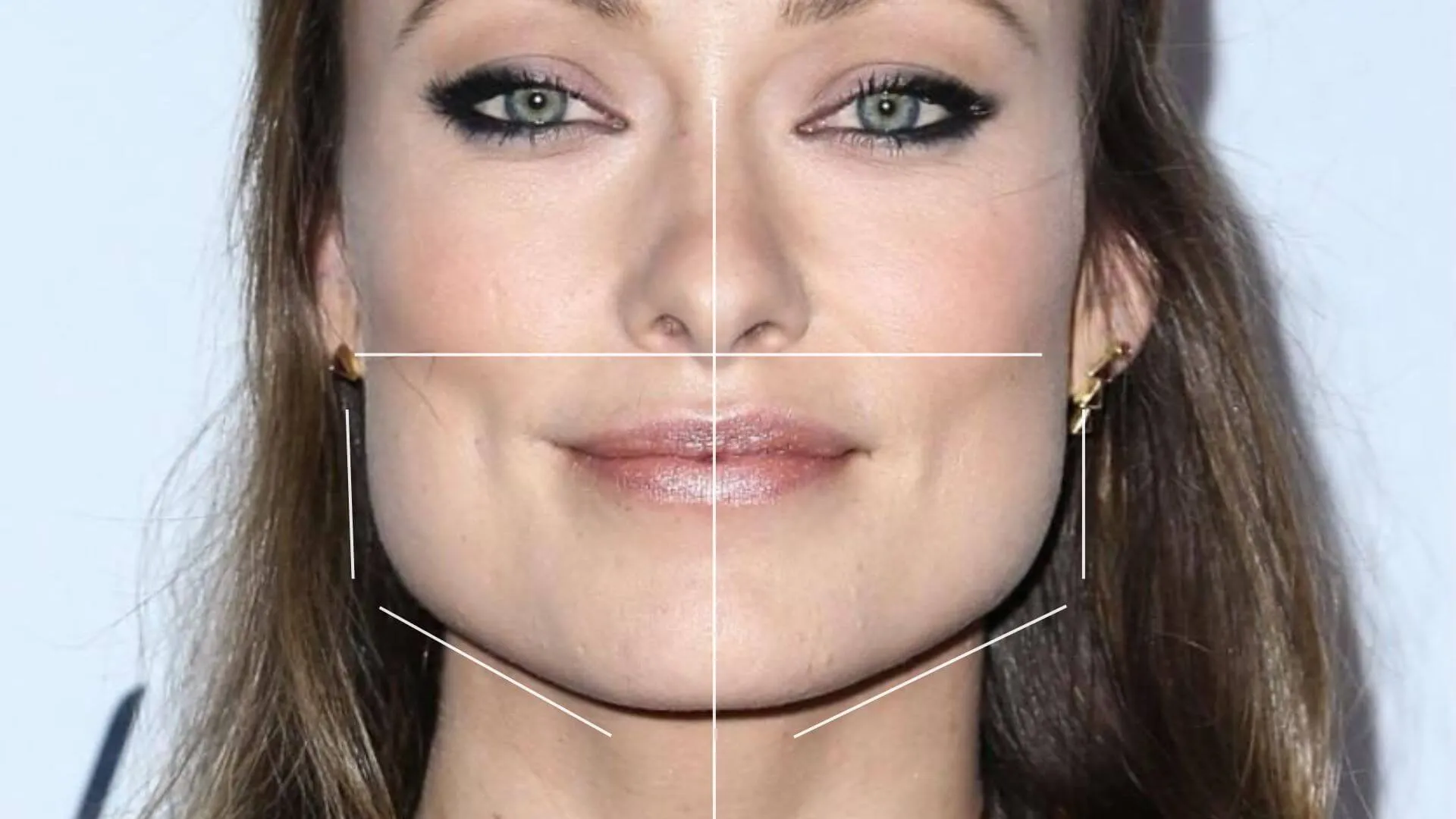 Squared Jawline AwardWinning Aesthetics Medical Clinic